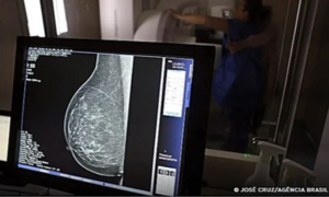 Agência Brasil / EBC – Saúde – Preconceito dificulta rastreio e tratamento de câncer em pessoas trans