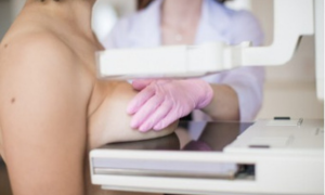 IstoÉ – Vigitel aponta cobertura expressiva de mamografia na faixa recomendada